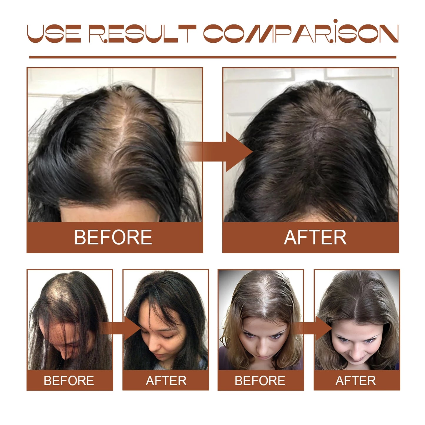 RootBloom™ Batana Hair Repair Oil
