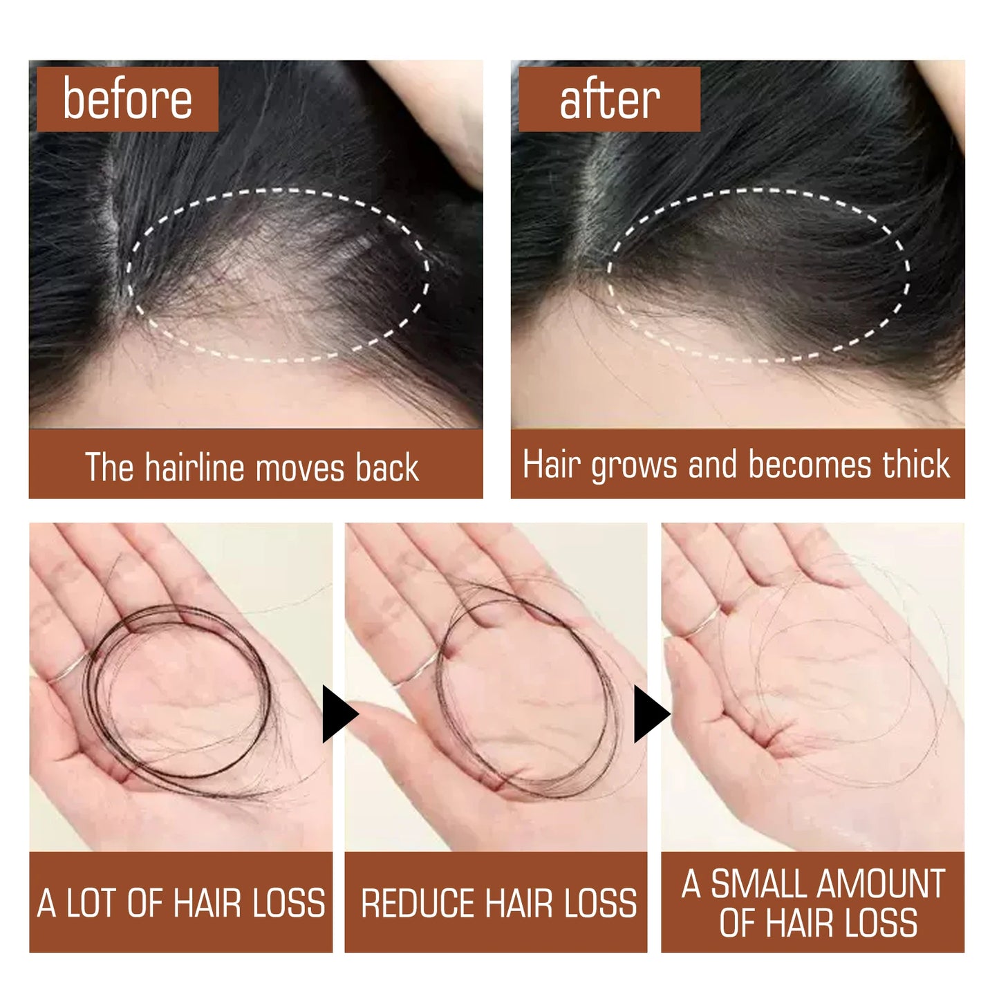 RootBloom™ Batana Hair Repair Oil